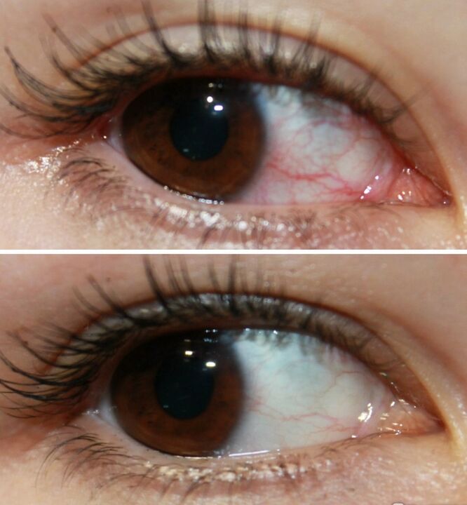 OCUVIT pôsobí veľmi rýchlo